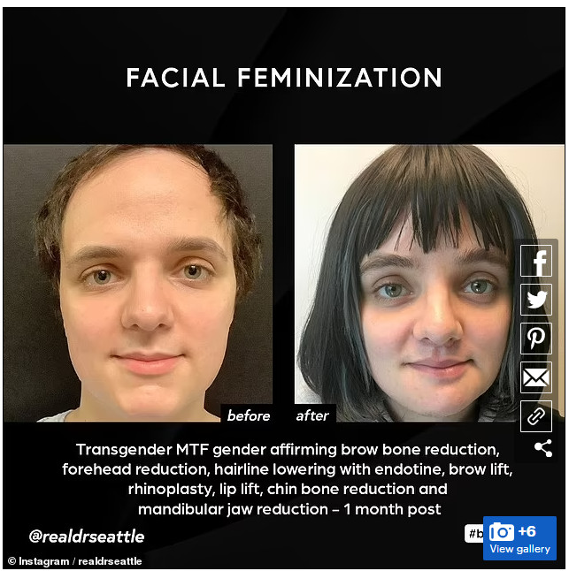 Before and After Patient Images